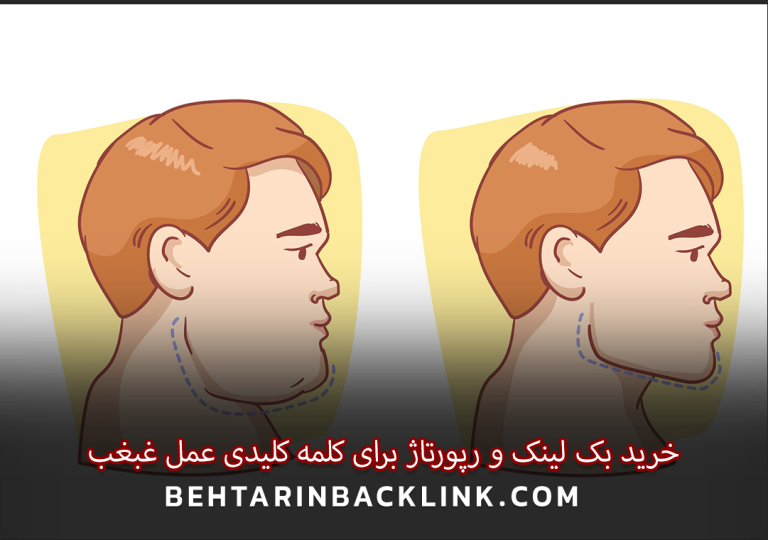 خرید بک لینک و رپورتاژ برای کلمه کلیدی عمل غبغب